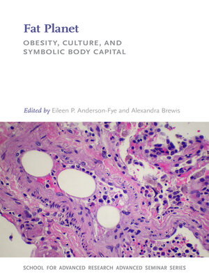 cover image of Fat Planet